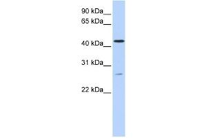 WB Suggested Anti-ACBD5 Antibody Titration:  0. (ACBD5 antibody  (C-Term))