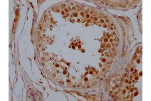 IHC image of ABIN7127809 diluted at 1:100 and staining in paraffin-embedded human testis tissue performed on a Leica BondTM system. (Recombinant SIRT1 antibody)
