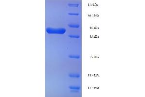 SDS-PAGE (SDS) image for Transgelin 2 (TAGLN2) (AA 2-199) protein (His-SUMO Tag) (ABIN5710448) (TAGLN2 Protein (AA 2-199) (His-SUMO Tag))