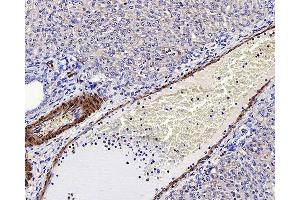 Immunohistochemistry analysis of paraffin-embedded rat liver using LDLR Polyclonal Antibody at dilution of 1:300. (LDLR antibody)
