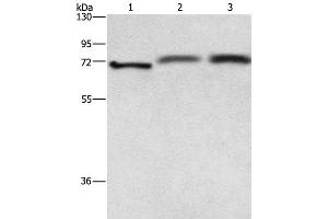 Western Blot analysis of Hela cell, Human fetal brain and hepatocellular carcinoma tissue using RDX Polyclonal Antibody at dilution of 1:700