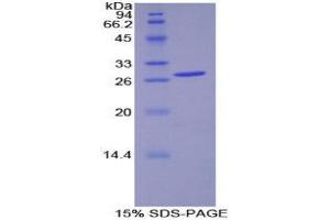 SDS-PAGE (SDS) image for Pyruvate Dehydrogenase Kinase 1 (PDK1) (AA 233-430) protein (His tag) (ABIN2126586)