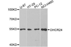 Western blot analysis of extracts of various cell lines, using DHCR24 antibody. (Seladin 1 antibody  (AA 227-516))