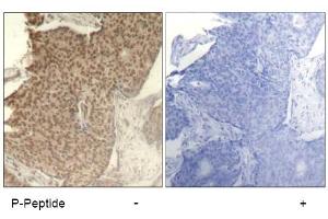 Image no. 4 for anti-Histone Deacetylase 2 (HDAC2) (pSer394) antibody (ABIN319238) (HDAC2 antibody  (pSer394))