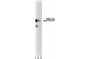 Western blot analysis of serine racemase in a mouse cerebrum lysate. (SRR antibody  (AA 127-248))