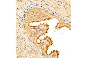 Immunohistochemistry of paraffin embedded rat fallopian tubes using PTPN2 (ABIN7075295) at dilution of 1:900 (400x lens)