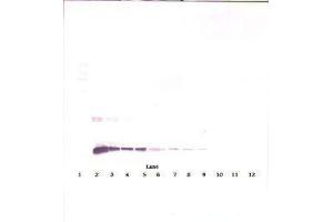 Image no. 1 for anti-Interleukin 10 (IL10) antibody (ABIN465277) (IL-10 antibody)