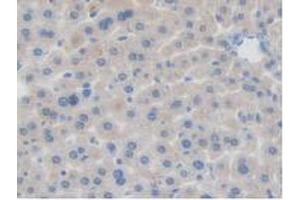 IHC-P analysis of Mouse Liver Tissue, with DAB staining. (BRD8 antibody  (AA 797-951))