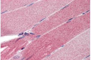Human Skeletal Muscle (formalin-fixed, paraffin-embedded) stained with FHL1 antibody ABIN462171 followed by biotinylated goat anti-rabbit IgG secondary antibody ABIN481713, alkaline phosphatase-streptavidin and chromogen. (FHL1 antibody  (AA 51-100))