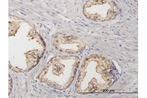 Immunoperoxidase of purified MaxPab antibody to SORD on formalin-fixed paraffin-embedded human prostate. (SORD antibody  (AA 1-357))