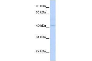 GSDML antibody used at 1 ug/ml to detect target protein. (Gasdermin B antibody  (N-Term))