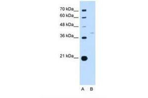 Image no. 1 for anti-Replication Factor C (Activator 1) 3, 38kDa (RFC3) (AA 91-140) antibody (ABIN6738211) (RFC3 antibody  (AA 91-140))