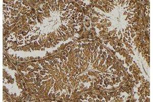 ABIN6276748 at 1/100 staining Mouse testis tissue by IHC-P. (BAD antibody  (Internal Region))