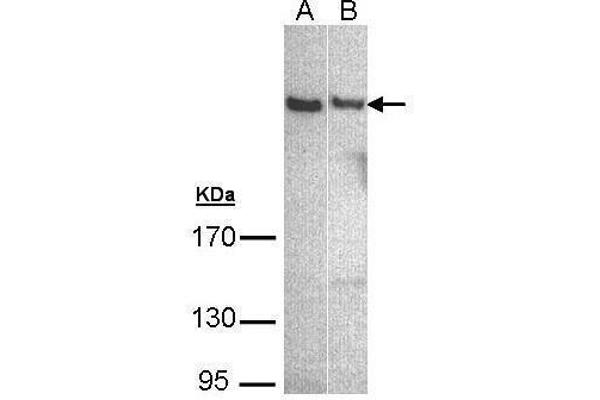 PLCH1 antibody