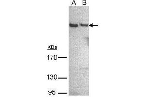 WB Image Sample (30 ug of whole cell lysate) A: A431 , B: Hep G2 , 5% SDS PAGE antibody diluted at 1:500
