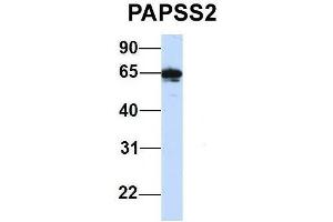 Host:  Rabbit  Target Name:  PAPSS2  Sample Type:  Human Hela  Antibody Dilution:  1.