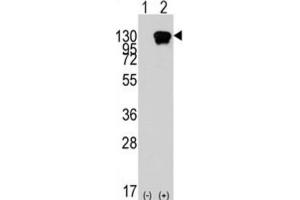 Western Blotting (WB) image for anti-Receptor Tyrosine Kinase-Like Orphan Receptor 1 (ROR1) antibody (ABIN2924492) (ROR1 antibody)