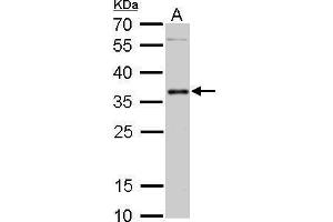 WB Image PIM2 antibody detects PIM2 protein by Western blot analysis. (PIM2 antibody  (Center))