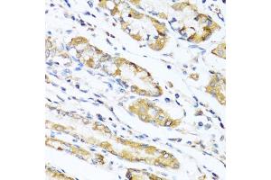 Immunohistochemistry of paraffin-embedded human stomach using LYZ antibody (ABIN5975352) at dilution of 1/100 (40x lens). (LYZ antibody)