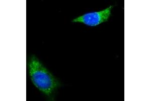 IF analysis of NDUFB8 using anti-NDUFB8 antibody (ABIN7599048).
