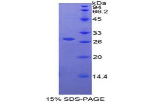 SDS-PAGE (SDS) image for Retinoic Acid Receptor, alpha (RARA) (AA 237-459) protein (His tag) (ABIN1878919) (Retinoic Acid Receptor alpha Protein (AA 237-459) (His tag))