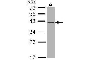 WB Image Sample (30 ug of whole cell lysate) A: MOLT4 , 10% SDS PAGE antibody diluted at 1:1000 (DNASE1 antibody)