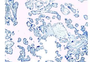 (ABIN184738) Negative Control showing staining of paraffin embedded Human Placenta, with no primary antibody.