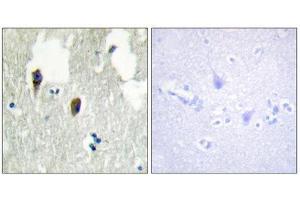 Immunohistochemistry (IHC) image for anti-Kelch-Like 3 (KLHL3) (N-Term) antibody (ABIN1850052) (KLHL3 antibody  (N-Term))