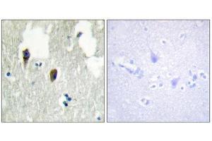 Immunohistochemistry (IHC) image for anti-Kelch-Like 3 (KLHL3) (N-Term) antibody (ABIN1850052) (KLHL3 antibody  (N-Term))