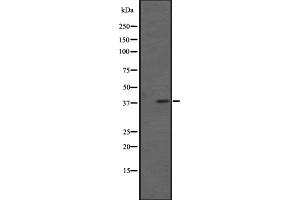 Western blot analysis of FPRL1 expression in Extracts from HL60 cells. (FPR2 antibody  (C-Term))