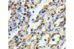 Used in DAB staining on fromalin fixed paraffin-embedded spleen tissue (IL5RA antibody  (AA 41-203))