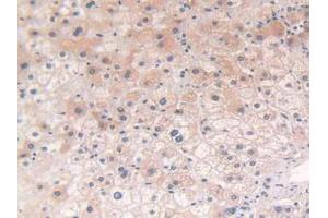 IHC-P analysis of Human Liver Tissue, with DAB staining. (POR antibody  (AA 77-518))