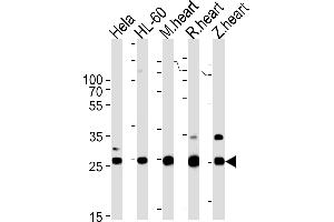 DANRE sdhb Antibody Azb10040a western blot analysis in Hela,HL-60 cell line,mouse heart,rat heart,zebra fish heart tissue lysates (35 μg/lane). (SDHB antibody  (AA 137-162))