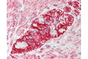 Human Colon, Myenteric plexus: Formalin-Fixed, Paraffin-Embedded (FFPE). (KLHL25 antibody  (AA 144-193))