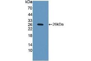 Detection of Recombinant iNV, Human using Polyclonal Antibody to Involucrin (INV) (Involucrin antibody  (AA 36-152))