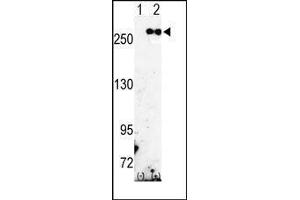 Western blot analysis of FASN (arrow) using rabbit polyclonal FASN Antibody (Fatty Acid Synthase antibody  (Middle Region))