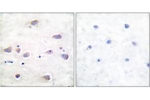 Immunohistochemistry analysis of paraffin-embedded human brain, using NMDAR1 (Phospho-Ser897) Antibody. (GRIN1/NMDAR1 antibody  (pSer897))