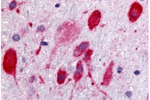 Anti-GPR171 antibody  ABIN1048756 IHC staining of rat brain, neurons.