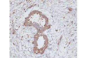Immunohistochemistry of paraffin-embedded Human breast using TGFBR2 Polyclonal Antibody at dilution of 1:100 (40x lens).