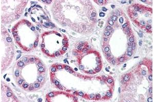 Human Kidney (formalin-fixed, paraffin-embedded) stained with PTK7 antibody ABIN343895 at 5 ug/ml followed by biotinylated goat anti-rabbit IgG secondary antibody ABIN481713, alkaline phosphatase-streptavidin and chromogen. (PTK7 antibody  (C-Term))