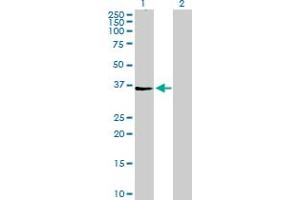 Western Blot analysis of AGPAT4 expression in transfected 293T cell line by AGPAT4 MaxPab polyclonal antibody. (AGPAT4 antibody  (AA 1-378))