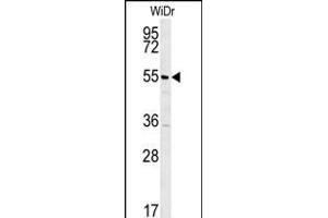 TSPYL4 Antibody (N-term) (ABIN652012 and ABIN2840495) western blot analysis in WiDr cell line lysates (35 μg/lane).