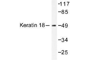 Image no. 1 for anti-Keratin 18 (KRT18) antibody (ABIN265498) (Cytokeratin 18 antibody)
