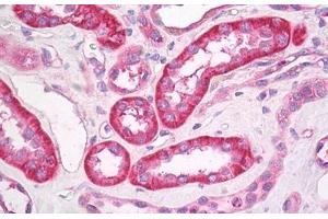 Human Kidney: Formalin-Fixed, Paraffin-Embedded (FFPE) (GABRB3 antibody  (AA 370-433))