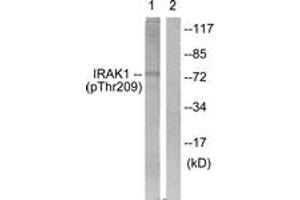 Western blot analysis of extracts from HeLa cells, using IRAK1 (Phospho-Thr209) Antibody.