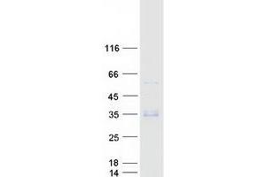 Validation with Western Blot (WFDC3 Protein (Myc-DYKDDDDK Tag))