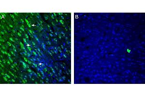 Expression of 5HT2A Receptor in rat cingulate cortex.