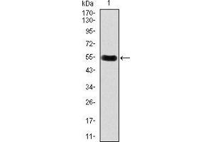 Western blot analysis using DKK3 mAb against human DKK3 recombinant protein.