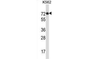Western Blotting (WB) image for anti-Interleukin 1 Receptor-Like 2 (IL1RL2) antibody (ABIN2997308) (IL1RL2 antibody)