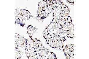 Immunohistochemistry of paraffin-embedded human placenta using TBX20 Rabbit pAb (ABIN7270698) at dilution of 1:100 (40x lens). (TBX20 antibody  (AA 1-290))